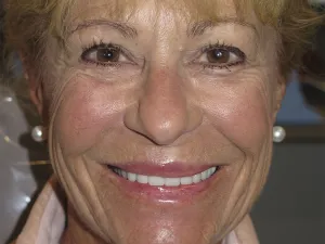 picture of case 602 smiling after