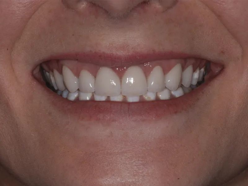 case 0109 smiles after photo