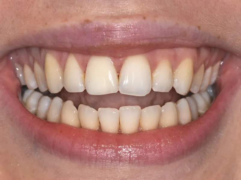 case 014 smile before photo