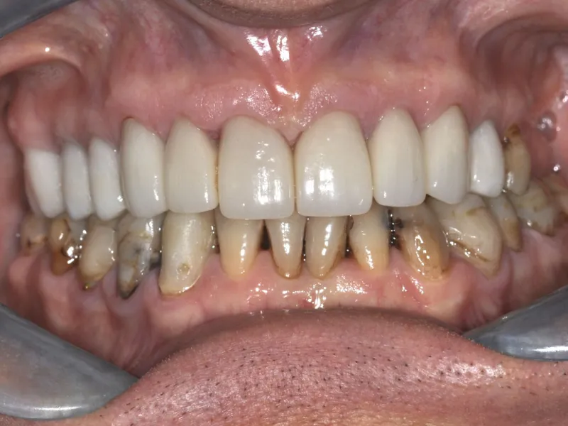 case 021 retracted after photo