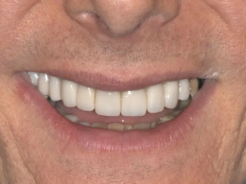 case 021 smile after photo