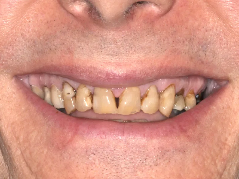 case 021 smile before photo