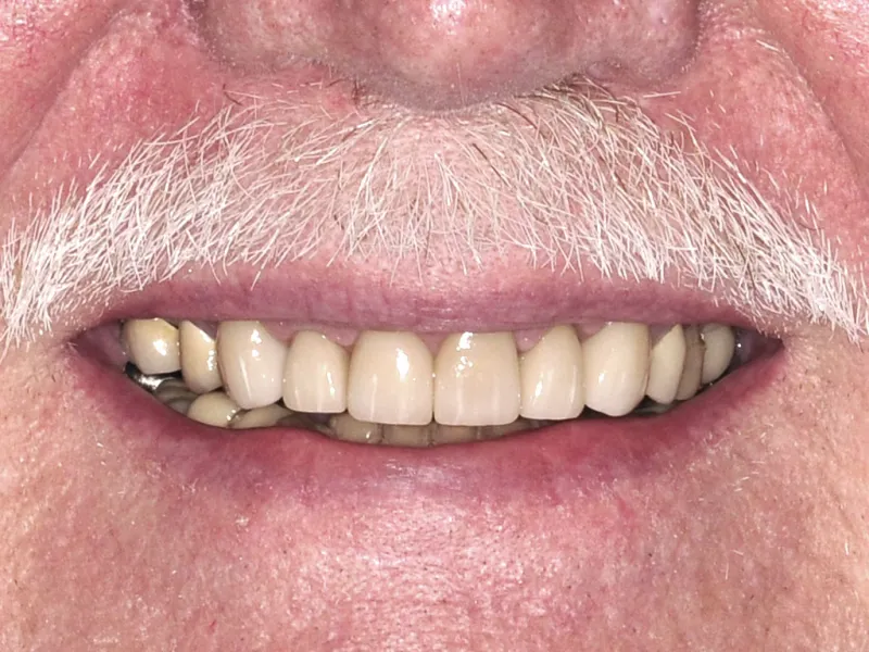 case 022 smile after photo