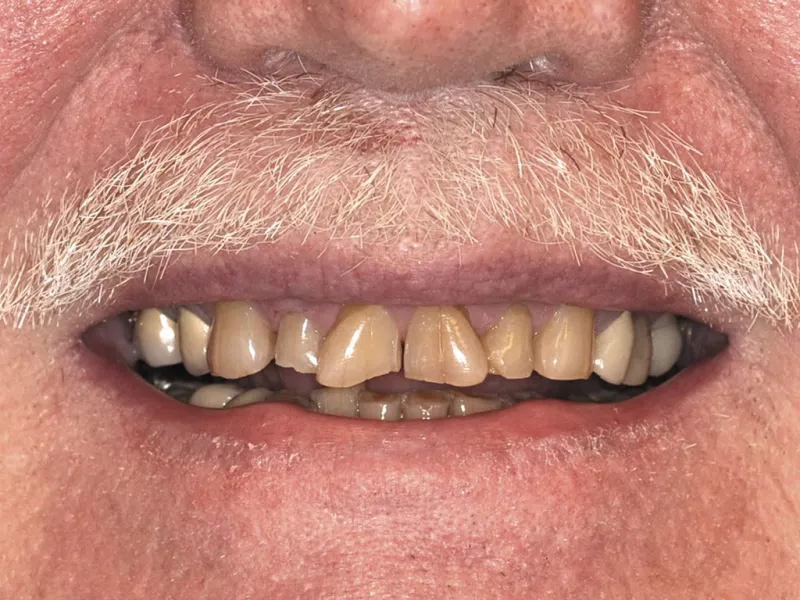 case 022 smile before photo
