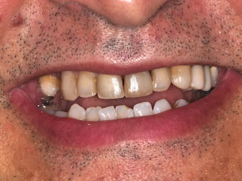 case 023 smile before photo