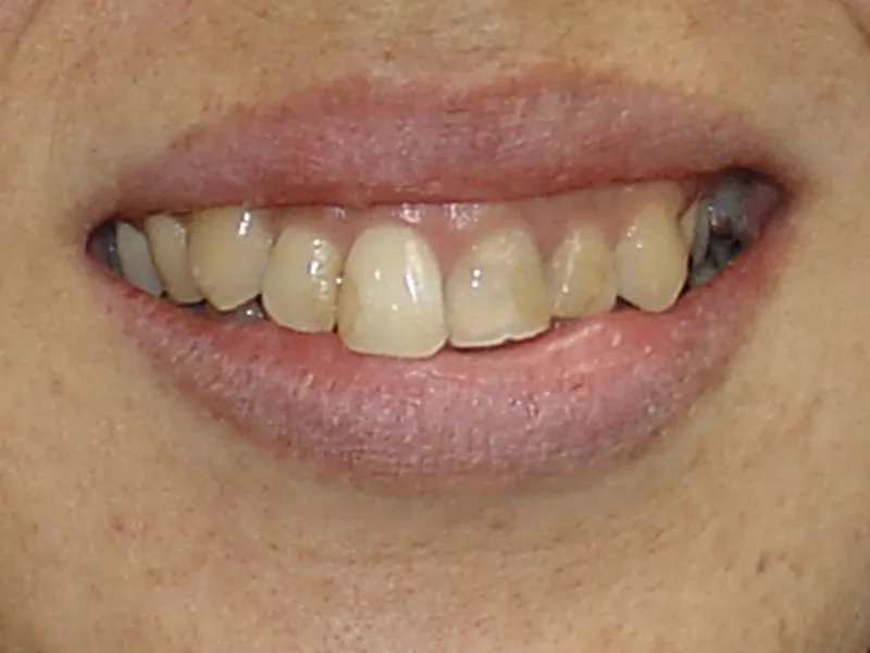 case 026 smile before photo