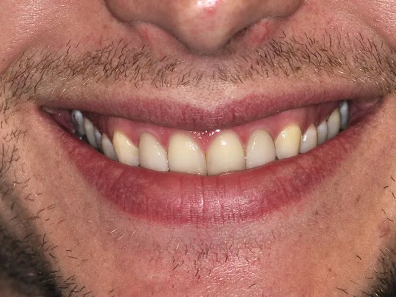case 028 smile after photo