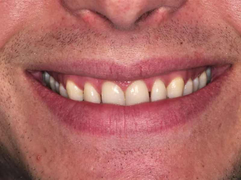 case 028 smile before photo