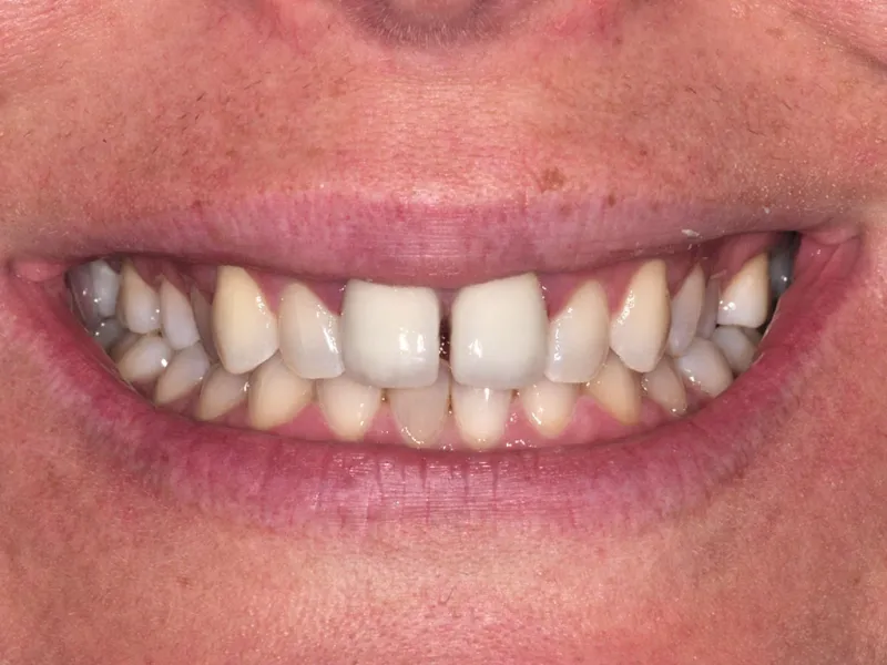 case 031 smile before photo