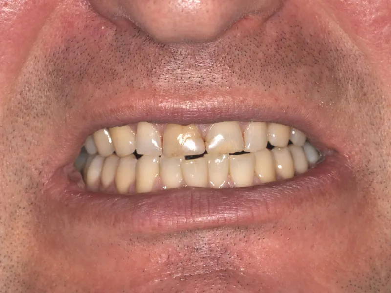 case 032 smile before photo