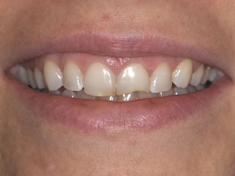 case 042 smile before photo