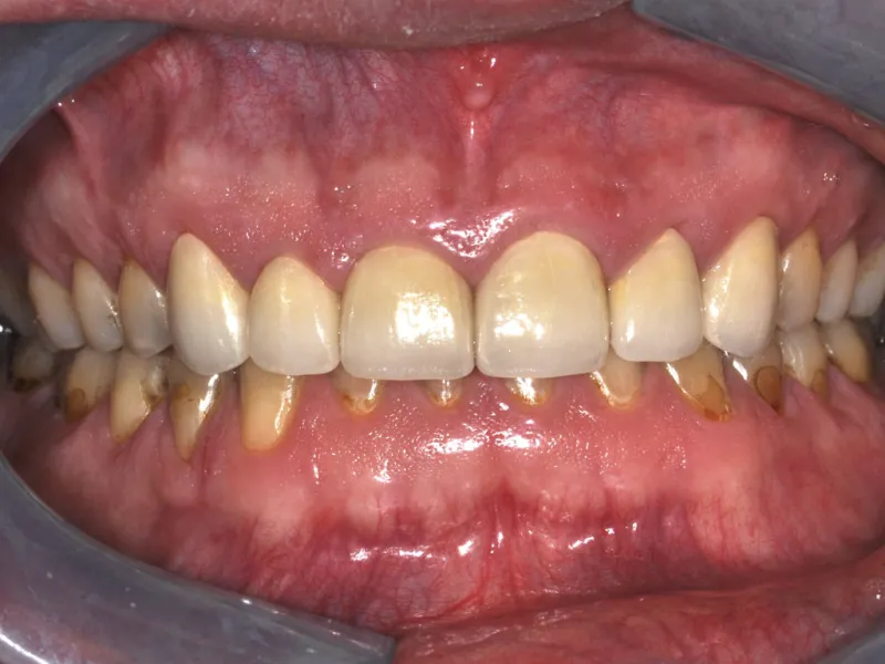 case 043 retracted after photo