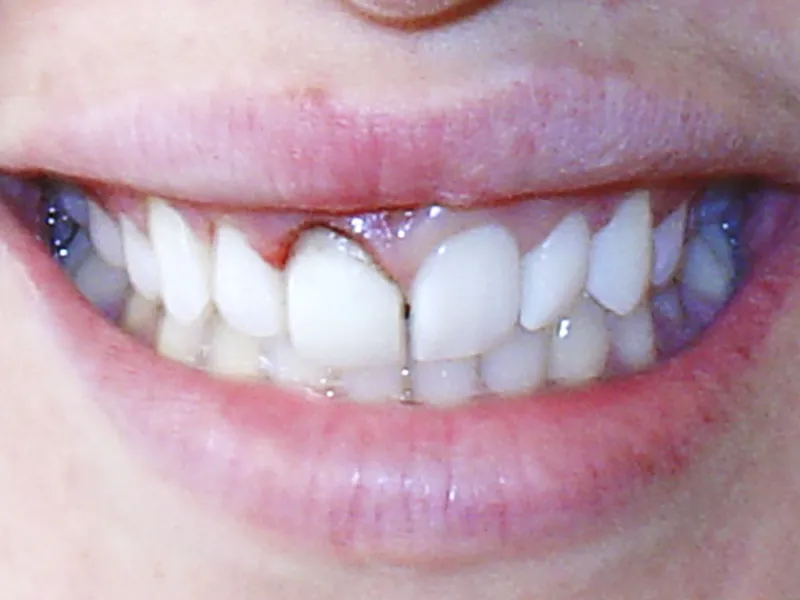 case 055 smile before photo