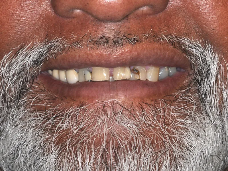 case 057 smile before photo