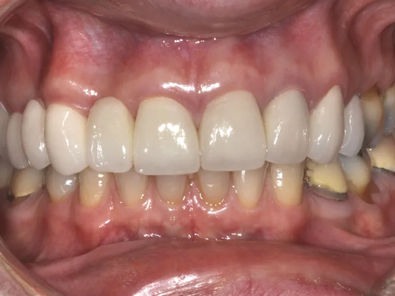 case 058 retracted after photo