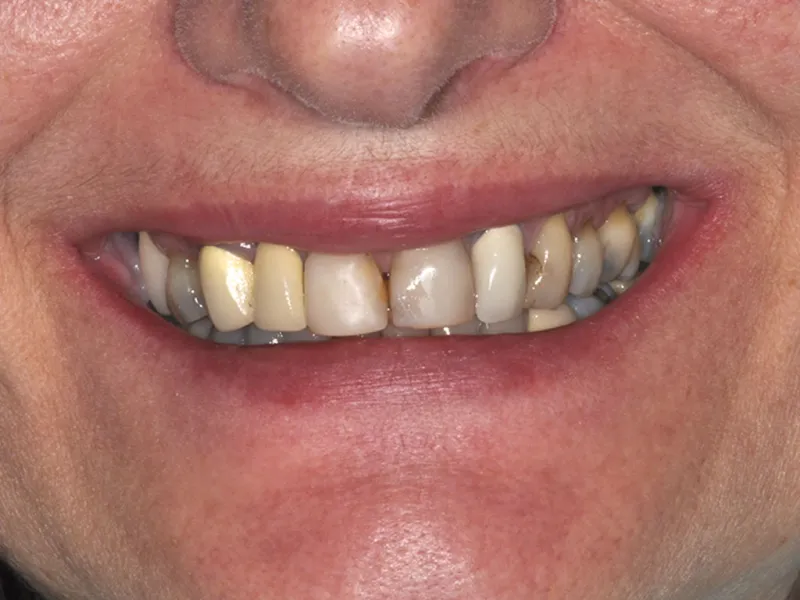 case 058 smile before photo