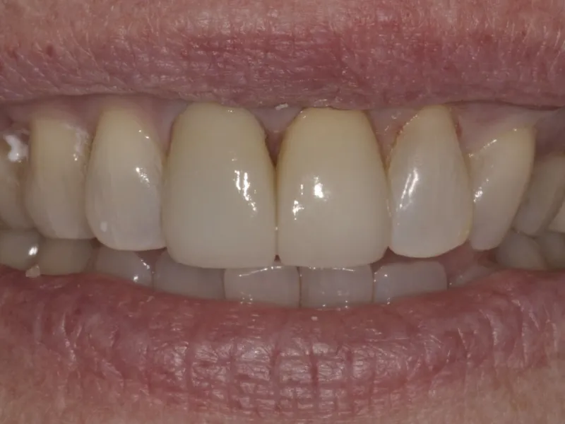 case 059 smile after photo