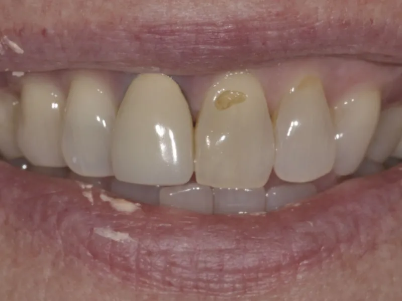 case 059 smile before photo