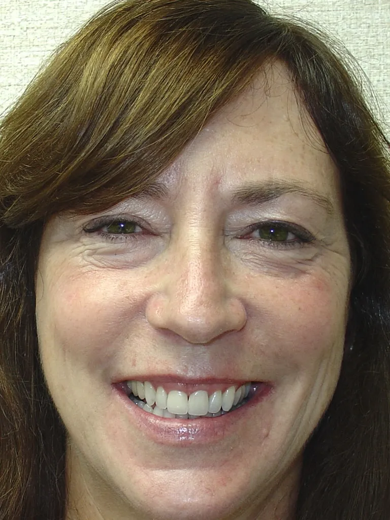case 060 portrait after photo