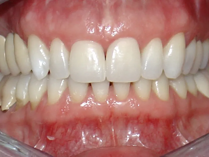 case 060 retracted after photo