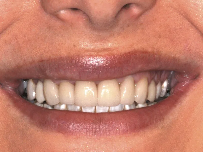 case 062 smile after photo