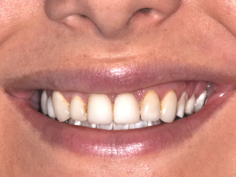 case 062 smile before photo
