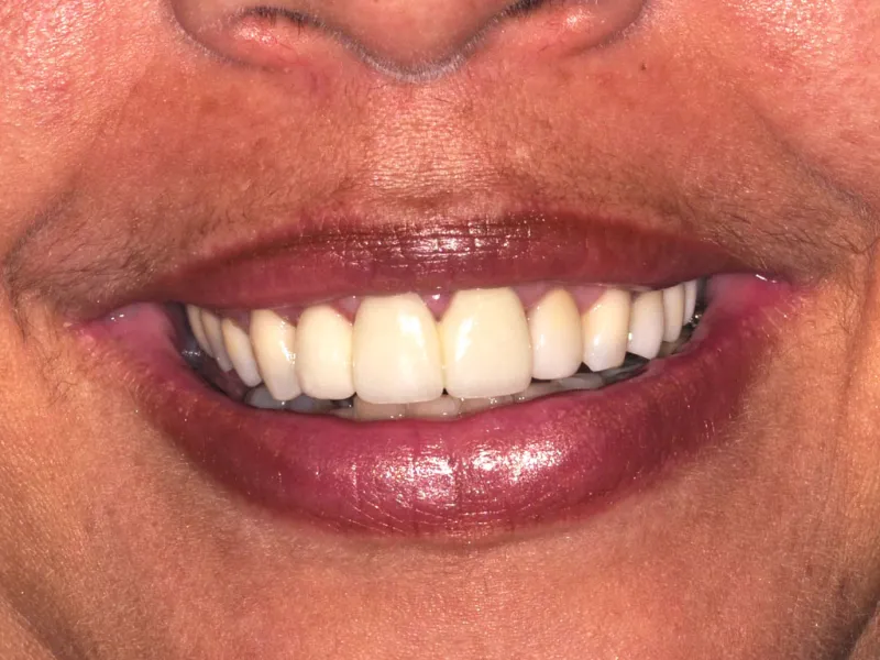 case 063 smile after photo