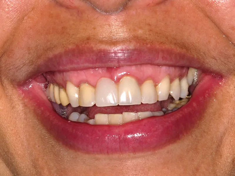 case 063 smile before
