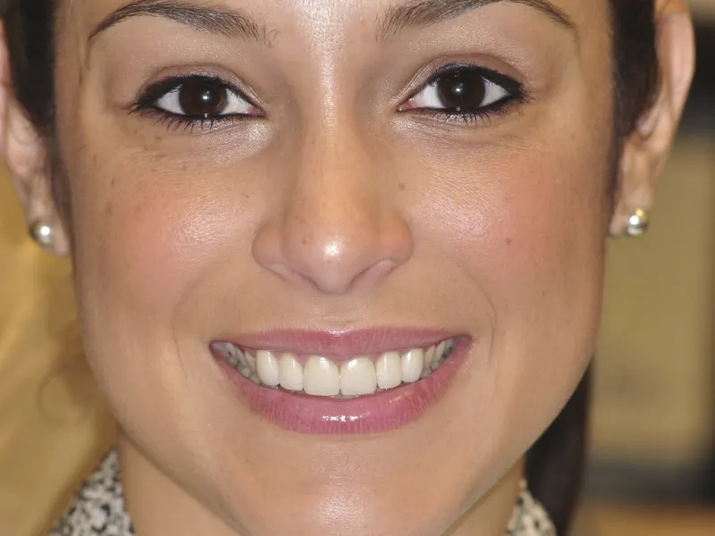 jackie smiling with nice teeth photo