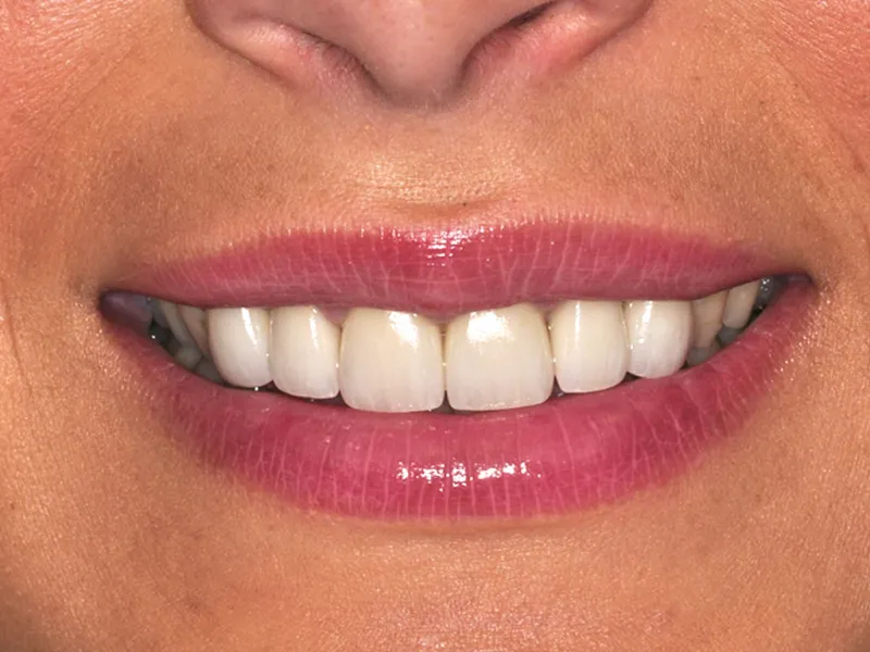 case 067 smile after photo