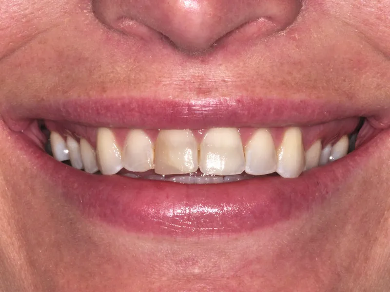 case 069 smile before photo