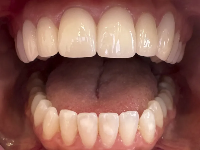 case 501 retracted after photo
