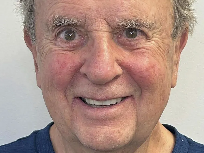 Case 503 Full Face After photo
