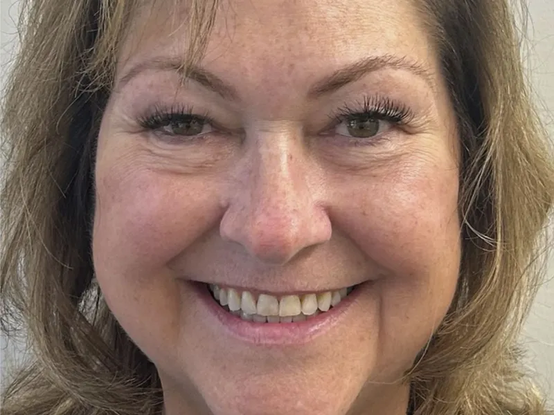 case 505 full face before photo