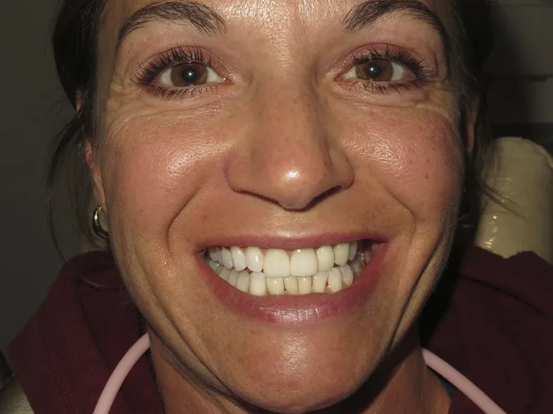 picture of case 604 smiling after