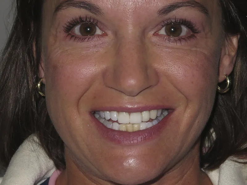 picture of case 604 smiling before