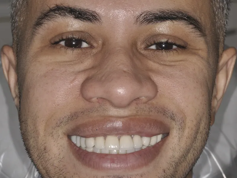 case 0100 full face photo