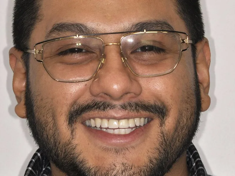 smiling man in glasses with nice teeth photo