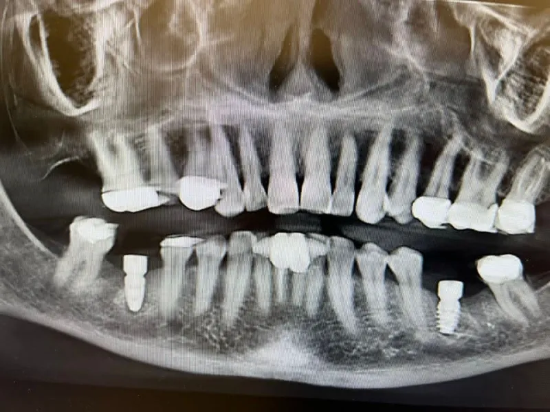 A before photo of an x-ray